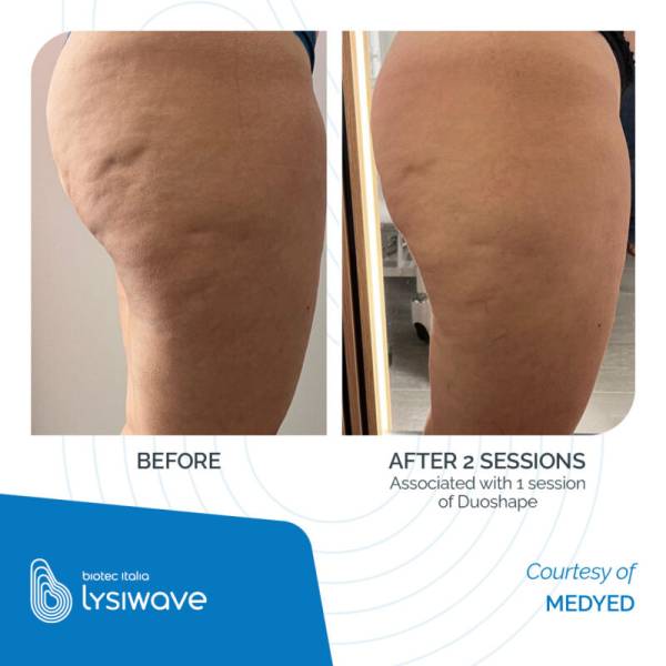 nouvelle contouring machine biotec italia 