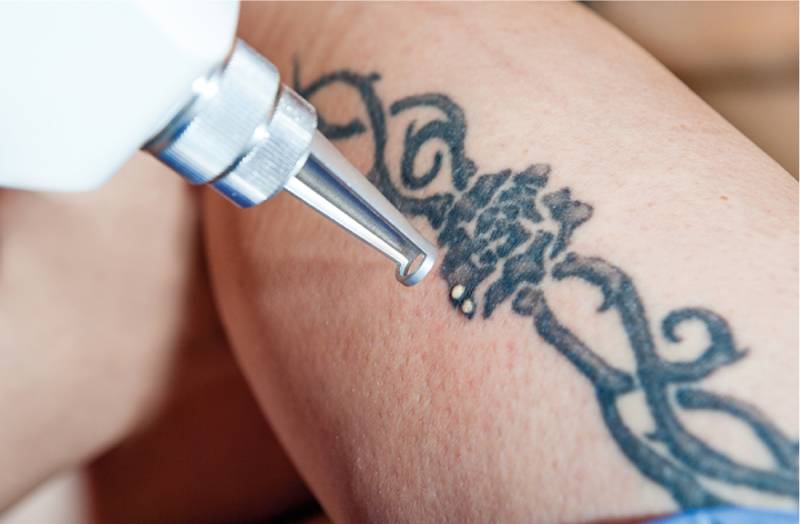  NPP Q-switch Nd:Yag 1064/532nm 